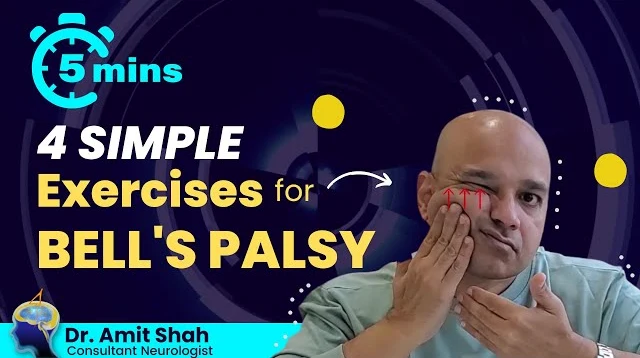 Bell’s Palsy Treatment and Recovery Insights by Dr. Amit Shah