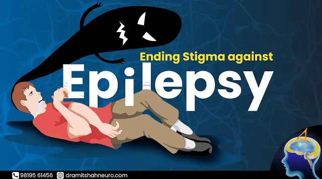 Ending Stigma Against Epilepsy | Patient Testimonial and Doctors Message