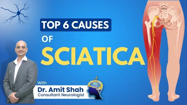 Top 6 causes of Sciatica Nerve Pain